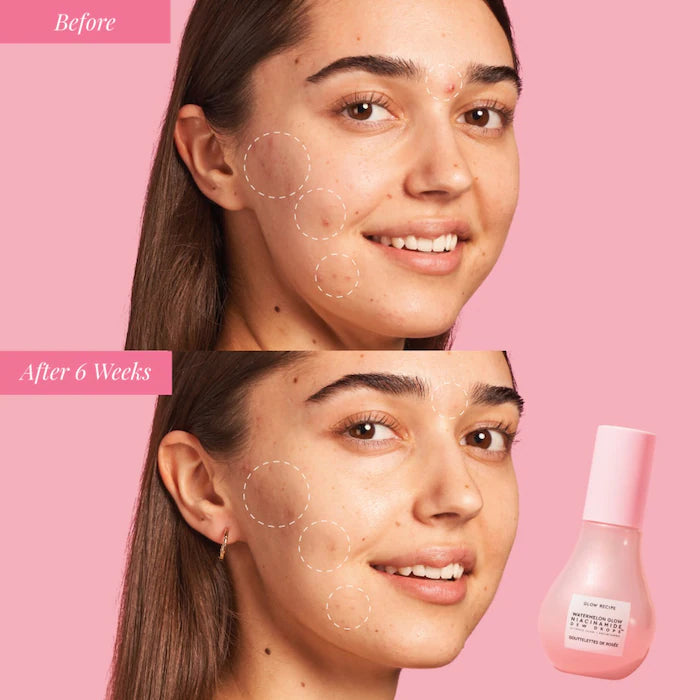 Pre Venta: Glow Recipe | Watermelon Glow Niacinamide Dew Drops Serum