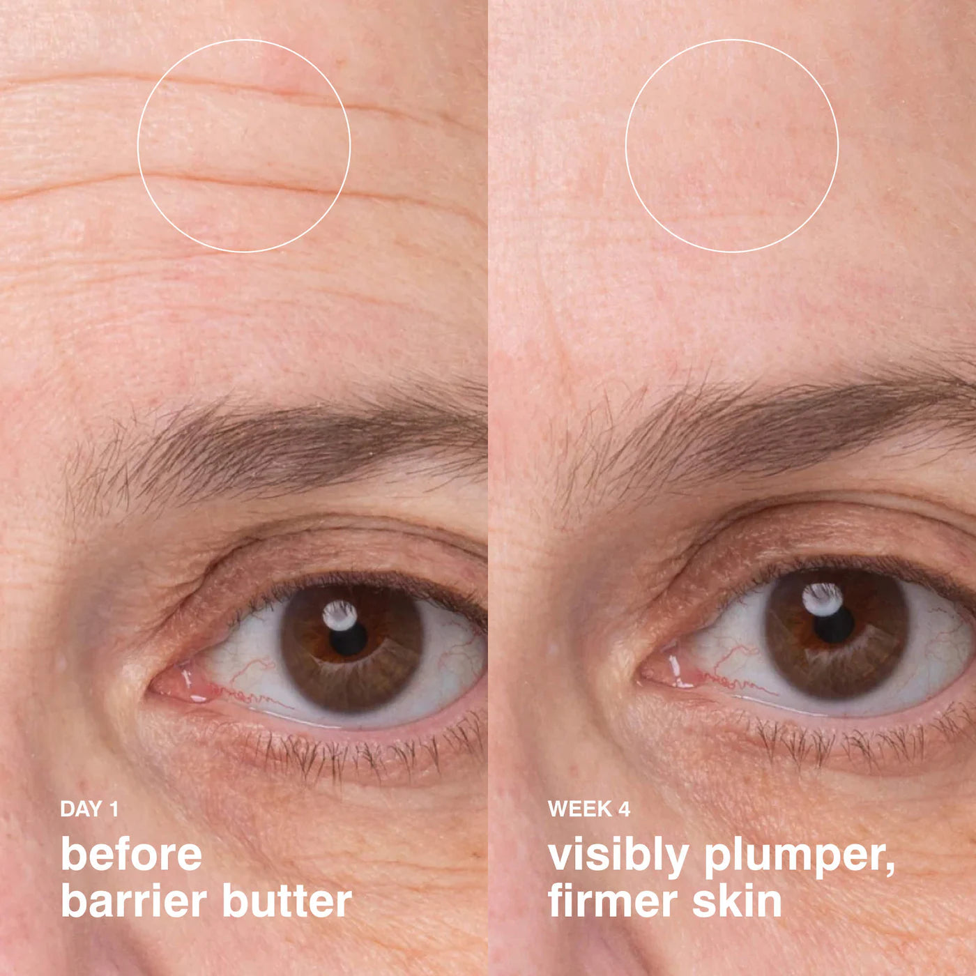 Pre Venta: Rhod | Barrier Butter Intensive Moisture Balm