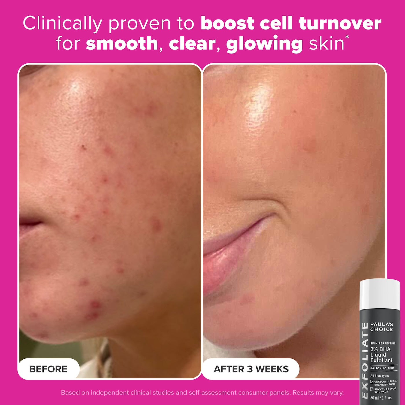 Pre Venta: Paula's Choice | Plump & Glow 3-Step Kit for Clear, Firm Skin