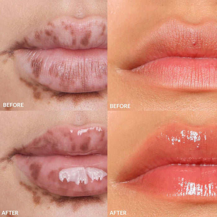 Pre Venta: Refy | Mini Lip Gloss Set
