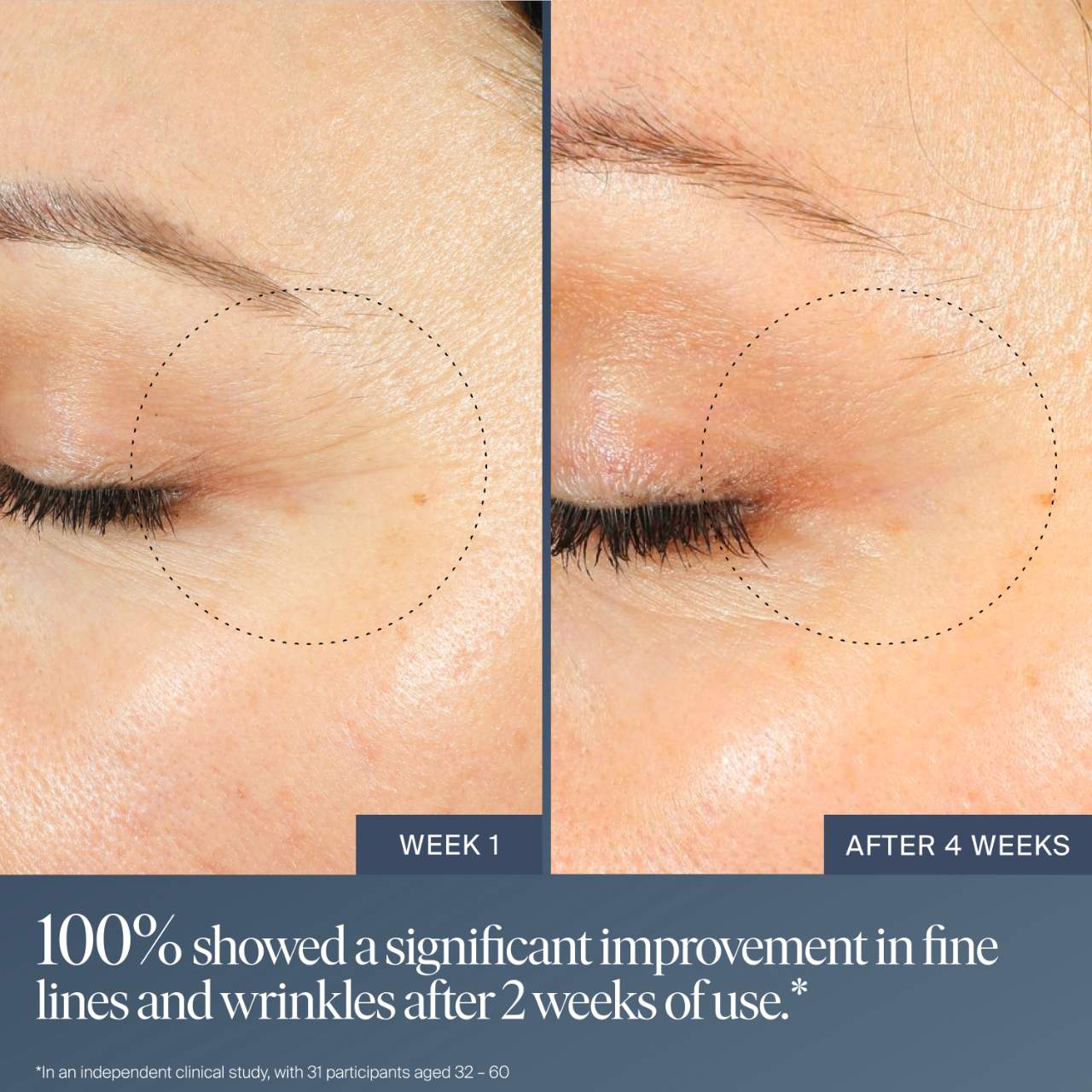 Pre Venta: Summer Fridays | Jet Lag Overnight Eye Serum for Fine Lines & Wrinkles with Gentle Retinol Blend
