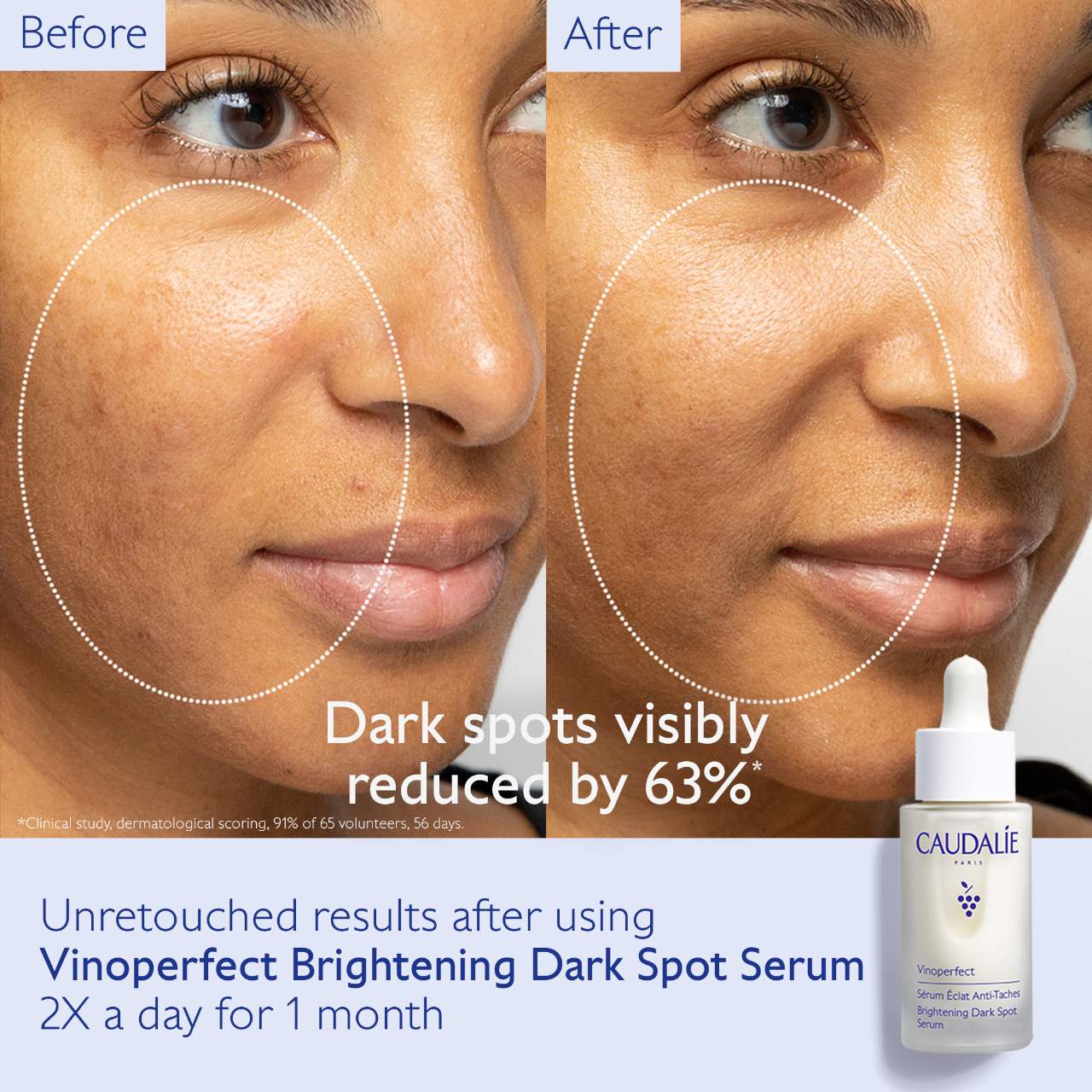Pre Venta: Caudalie | Vinoperfect Brightening Routine for Dark Spots and Uneven Skin Tone