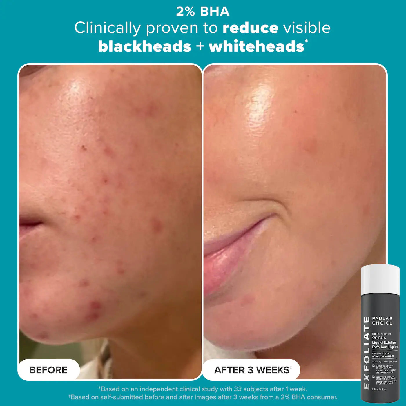 Pre Venta: Paula's Choice | Smooth & Glow Gift Set for clearer, brighter skin