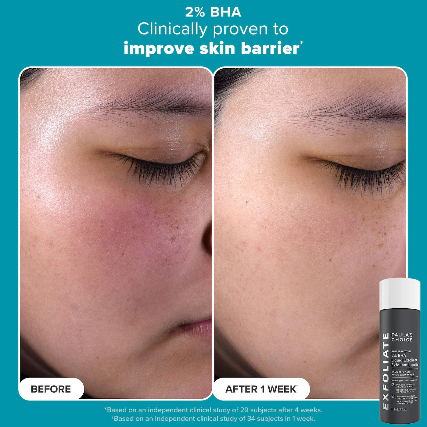 Pre Venta: Paula's Choice | Smooth & Glow Gift Set for clearer, brighter skin
