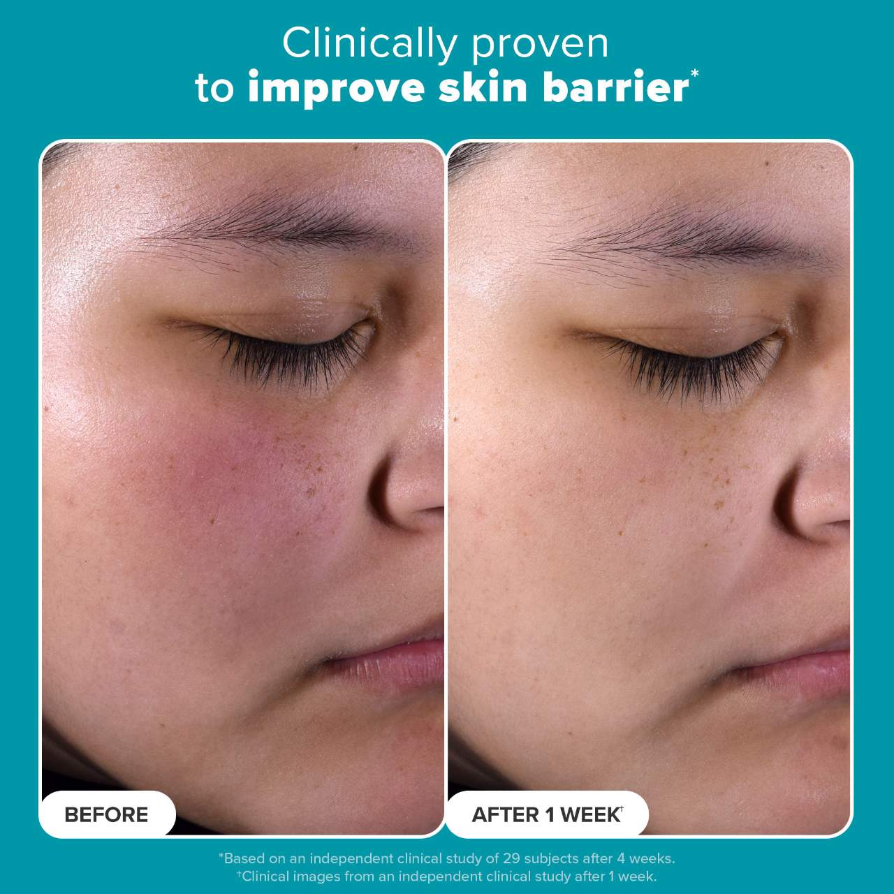 Pre Venta: Paula's Choice | Skin Perfecting 2% BHA Exfoliating Toner for Clear Skin