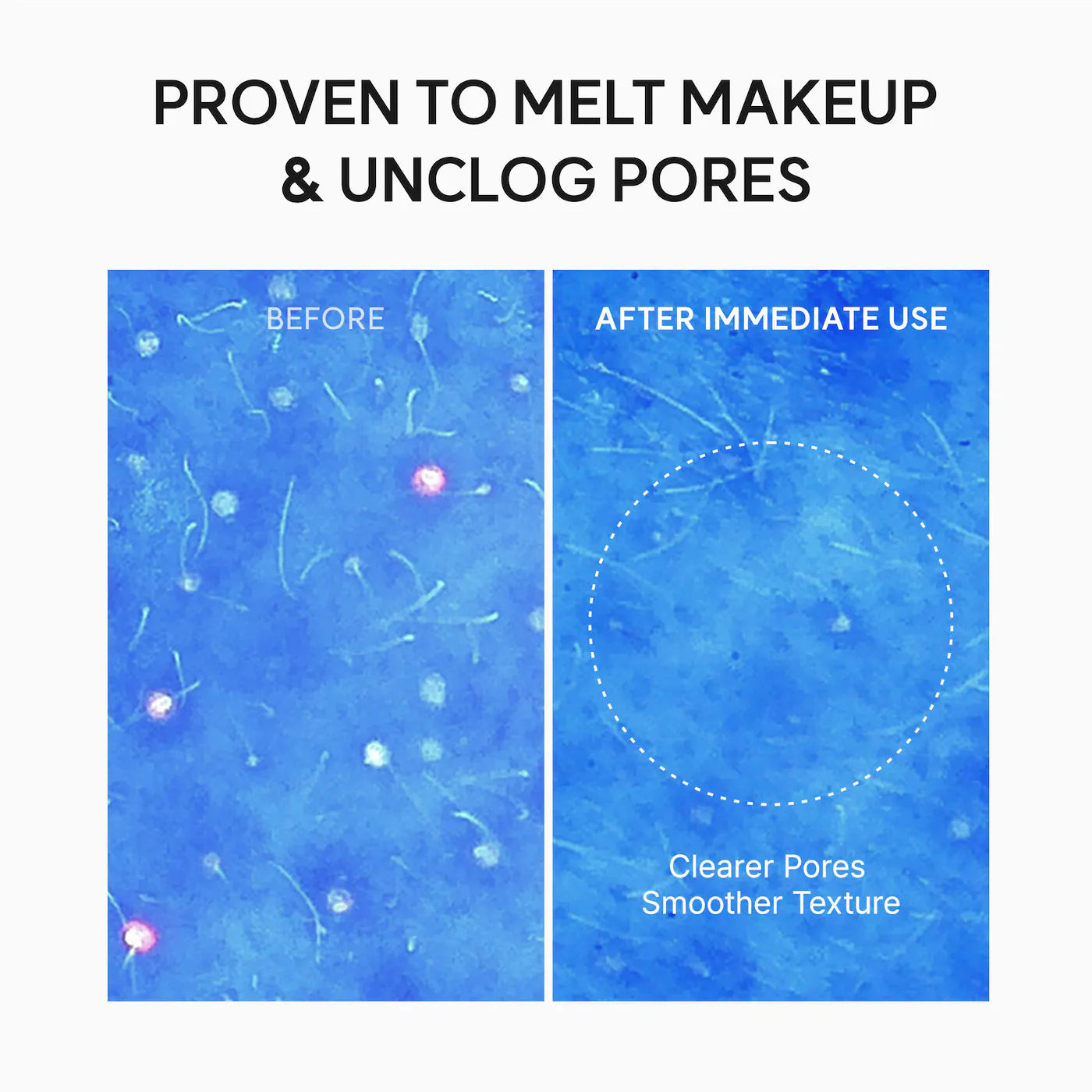 Pre Venta: Arencia | Pore Melt Non-Comedogenic Double Cleansing Duo Gift Set for Acne-Prone Skin